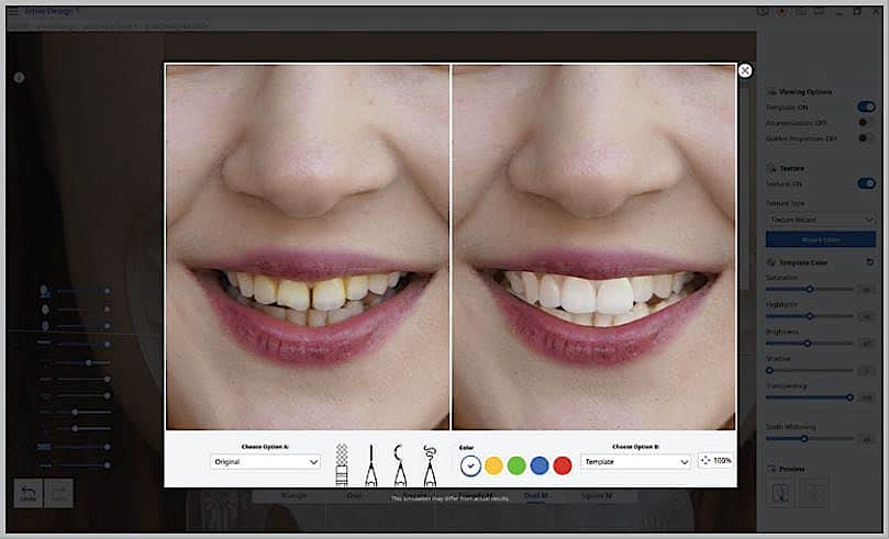 Smile Design - Zeigen Sie dem Patienten sein zukünftiges Lächeln